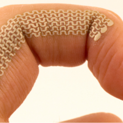 E-tattoos turn knuckles and freckles into smarphone controls