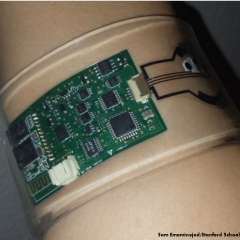 Wearable sweat sensor can diagnose cystic fibrosis, diabetes and other diseases