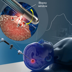 An optical biopsy needle to diagnose cancer